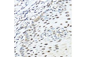Immunohistochemistry of paraffin-embedded human esophageal using VCP Rabbit pAb (ABIN3016711, ABIN3016712, ABIN3016713 and ABIN6219823) at dilution of 1:100 (40x lens). (VCP 抗体)
