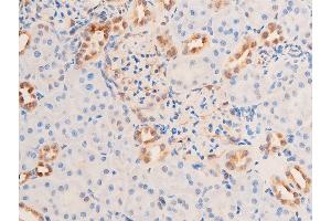ABIN6267073 at 1/100 staining rat kidney tissue sections by IHC-P. (CHEK1 抗体  (pSer280))