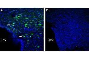 Expression of /LRRC4 in rat hypothalamus. (LRRC4 抗体  (Extracellular))