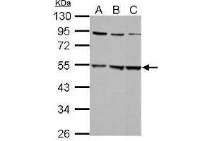WB Image Sample (30 ug of whole cell lysate) A: 293T B: A431 C: HepG2 10% SDS PAGE antibody diluted at 1:5000 (GLRa2 抗体)