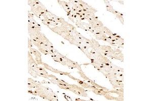 Immunohistochemistry of paraffin embedded rat heart using smad62024 (ABIN7075629) at dilution of 1:1000 (400x lens) (SMAD6 抗体)