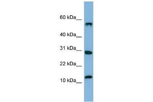 WB Suggested Anti-SRAntibody Titration:  0. (SRP19 抗体  (Middle Region))