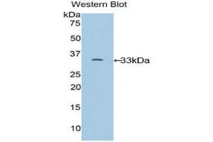 Western Blotting (WB) image for anti-Cytochrome P450, Family 24, Subfamily A, Polypeptide 1 (CYP24A1) (AA 260-514) antibody (ABIN1858590)