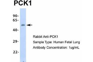 Host: Rabbit  Target Name: PCK1  Sample Tissue: Human Fetal Lung  Antibody Dilution: 1. (PCK1 抗体  (Middle Region))