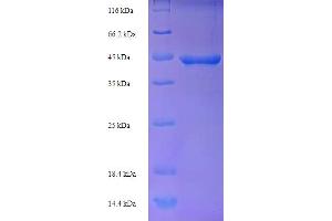 SDS-PAGE (SDS) image for Recoverin (RCVRN) (AA 1-242), (full length) protein (His-SUMO Tag) (ABIN5711107)