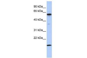 WB Suggested Anti-TRIAntibody Titration:  0. (TRIP10 抗体  (Middle Region))