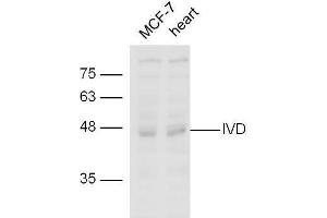 line1,MCF-7 lysates；line2,mouse heart lysate probed with Rabbit Anti-IVD Polyclonal Antibody, Unconjugated  at 1:5000 for 90min at 37˚C. (IVD 抗体  (AA 201-300))