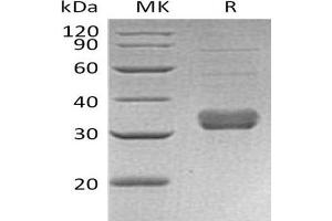 Western Blotting (WB) image for Collectin Sub-Family Member 11 (COLEC11) protein (His tag) (ABIN7320843) (COLEC11 Protein (His tag))