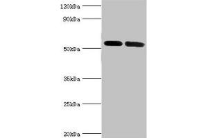 Western blot All lanes: V-type proton ATPase subunit B, kidney isoform antibody at 7 μg/mL Lane 1: Mouse kidney tissue Lane 2: 293T whole cell lysate Secondary Goat polyclonal to rabbit IgG at 1/10000 dilution Predicted band size: 57 kDa Observed band size: 57 kDa (ATP6V1B1 抗体  (AA 1-280))