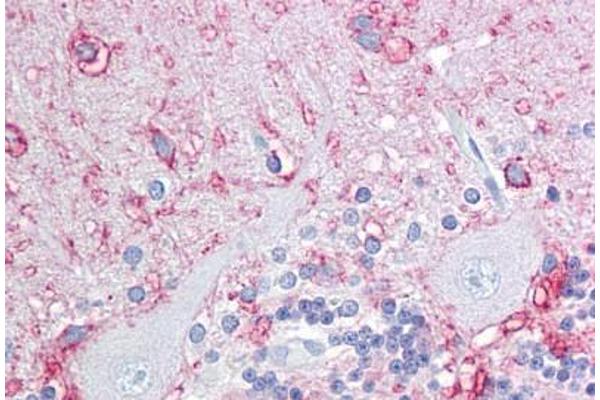Anosmin 抗体  (Internal Region)