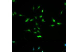 Immunofluorescence analysis of A549 cells using MDM2 Polyclonal Antibody (MDM2 抗体)