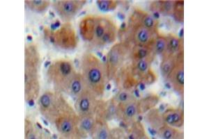 IHC-P analysis of Liver tissue, with DAB staining. (DVL1 抗体  (AA 150-332))