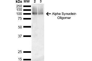 Western Blot analysis of Mouse, Rat Brain showing detection of 14 kDa Alpha Synuclein protein using Mouse Anti-Alpha Synuclein Monoclonal Antibody, Clone 3C11 (ABIN5564064). (SNCA 抗体  (Biotin))