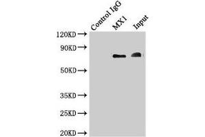 Immunoprecipitating MX1 in Hela whole cell lysate Lane 1: Rabbit control IgG instead of (1 μg) instead of ABIN7156641 in Hela whole cell lysate. (MX1 抗体  (AA 7-172))