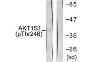 Western blot analysis of extracts from HepG2 cells treated with PDGF 50ng/ml 30', using Akt1 S1 (Phospho-Thr246) Antibody. (PRAS40 抗体  (pThr246))