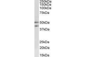 Western Blotting (WB) image for anti-Meis Homeobox 2 (MEIS2) (Internal Region) antibody (ABIN2464672)