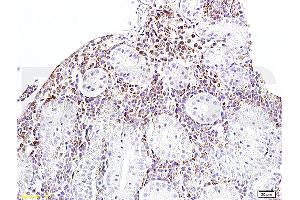 Immunohistochemistry (IHC) image for anti-B-Cell CLL/lymphoma 2 (BCL2) (AA 101-160) antibody (ABIN723920)