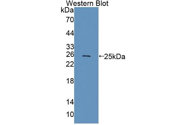 TASP1 anticorps  (AA 234-420)