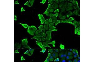 Immunofluorescence analysis of A549 cells using NCS1 Polyclonal Antibody (NCS1 抗体)