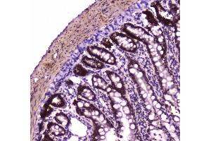 Immunohistochemistry (IHC) image for anti-SWI/SNF Related, Matrix Associated, Actin Dependent Regulator of Chromatin, Subfamily A, Member 4 (SMARCA4) (AA 555-763) antibody (ABIN5692863)