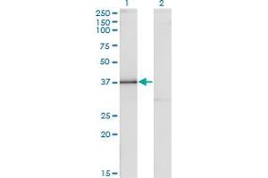 Western Blot analysis of DLX3 expression in transfected 293T cell line by DLX3 monoclonal antibody (M09), clone 3F7. (DLX3 抗体  (AA 1-287))