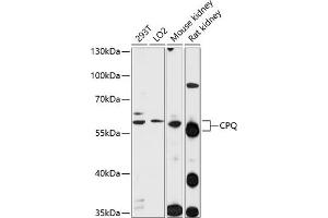 Western blot analysis of extracts of various cell lines, using CPQ antibody  at 1:1000 dilution. (CPQ 抗体  (AA 1-100))