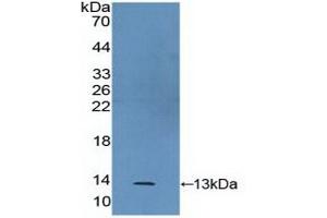 Detection of Recombinant S100A2, Human using Polyclonal Antibody to S100 Calcium Binding Protein A2 (S100A2) (S100A2 抗体  (AA 2-98))
