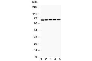 Western blot testing of IKK alpha antibody and Lane 1:  MCF-7 (IKK alpha 抗体  (AA 411-745))