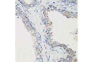 Immunohistochemistry of paraffin-embedded human prostate using GLUD1 antibody at dilution of 1:200 (40x lens). (GLUD1 抗体)