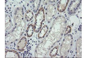 Image no. 1 for anti-Cancer/testis Antigen 1B (CTAG1B) antibody (ABIN1499893) (CTAG1B 抗体)