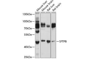 Western blot analysis of extracts of various cell lines, using SFTPB Antibody (ABIN6147687) at 1:1000 dilution. (SFTPB 抗体  (AA 94-393))