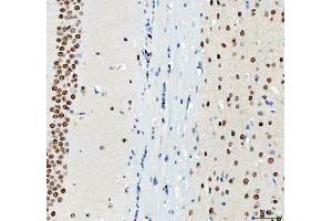 IHC analysis of DDX1 using anti-DDX1 antibody (ABIN7602052). (DDX1 抗体  (AA 562-740))