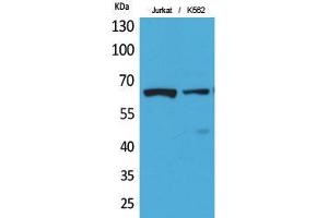 Western Blot (WB) analysis of Jurkat, K562 cells using Acetyl-NFkappaB-p65 (K218) Polyclonal Antibody. (NF-kB p65 抗体  (acLys218))