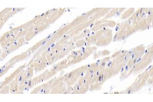 Detection of IL18 in Rabbit Cardiac Muscle Tissue using Polyclonal Antibody to Interleukin 18 (IL18) (IL-18 抗体  (AA 32-192))