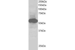 ABIN185071 staining (1µg/ml) of Human Kidney lysate (RIPA buffer, 30µg total protein per lane). (SIL1 抗体  (C-Term))