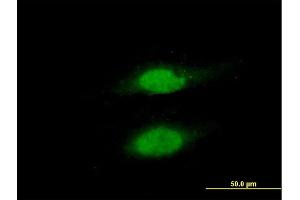 Immunofluorescence of purified MaxPab antibody to RAD23B on HeLa cell. (RAD23B 抗体  (AA 1-409))
