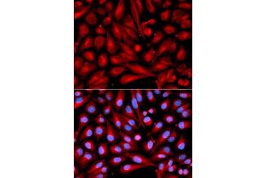 Immunofluorescence analysis of U2OS cells using MAP2K7 antibody (ABIN5971212). (MAP2K7 抗体)
