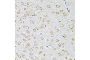 Immunohistochemistry of paraffin-embedded mouse brain using NTS antibody (ABIN5998396) at dilution of 1/100 (40x lens). (Neurotensin 抗体)