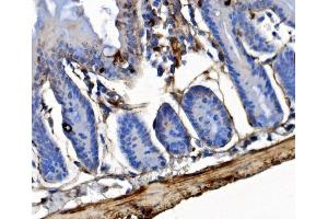 IHC analysis of Integrin Linked ILK using anti-Integrin Linked ILK antibody (ABIN7599411). (ILK 抗体  (AA 1-452))