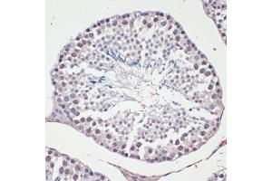 Immunohistochemistry (IHC) image for anti-Jun Proto-Oncogene (JUN) (AA 1-70) antibody (ABIN6142670)