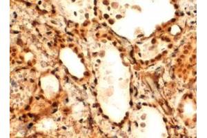 Antibody (2µg/ml) staining of paraffin embedded Human Thyroid Gland. (FOXE1 抗体  (C-Term))