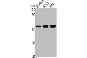 Western Blot analysis of Jurkat K562 NIH-3T3 cells using ENT1 Polyclonal Antibody (SLC29A1 抗体  (N-Term))