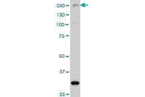ARID1B monoclonal antibody (M02), clone 2F2 Western Blot analysis of ARID1B expression in Hela S3 NE . (ARID1B 抗体  (AA 1364-1460))