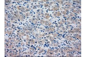 Immunohistochemical staining of paraffin-embedded pancreas tissue using anti-NRBP1mouse monoclonal antibody. (NRBP1 抗体)