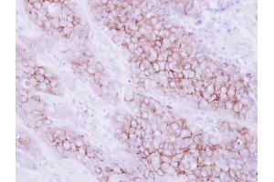 Immunohistochemistry (IHC) image for anti-Killer Cell Immunoglobulin-Like Receptor, Two Domains, Long Cytoplasmic Tail, 4 (KIR2DL4) (Center) antibody (ABIN2856036)