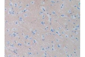 Figure. (SIRPA 抗体  (AA 105-324))