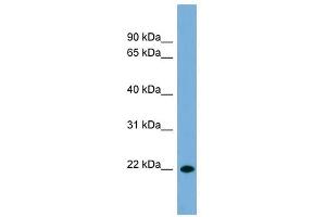 CD8B antibody used at 1 ug/ml to detect target protein. (CD8B 抗体  (Middle Region))