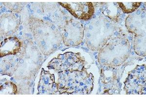 Immunohistochemistry of paraffin-embedded Rat kidney using PDE3A Polyclonal Antibody at dilution of 1:100 (40x lens). (PDE3A 抗体)