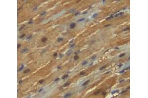 IHC-P analysis of heart tissue, with DAB staining. (KEAP1 抗体  (AA 1-286))