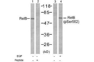 Image no. 1 for anti-V-Rel Reticuloendotheliosis Viral Oncogene Homolog B (RELB) (Ser552) antibody (ABIN197500) (RELB 抗体  (Ser552))